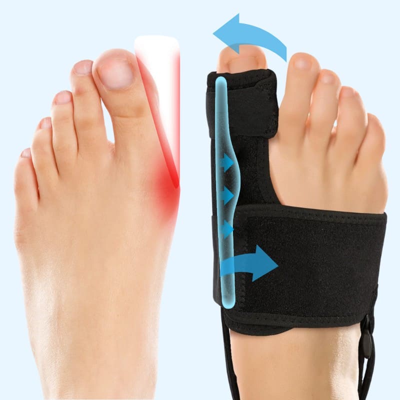 Valgux™ Tutore | Correttore dell’alluce valgo (Hallux Valgus)