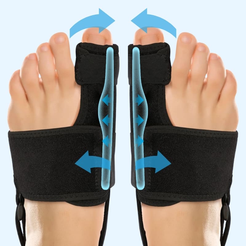 Valgux™ Tutore | Correttore dell’alluce valgo (Hallux Valgus)