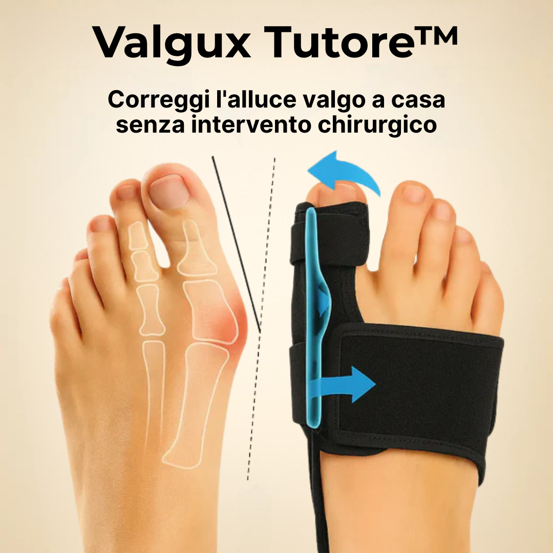 Valgux Tutore™ | Correttore dell’alluce valgo (Hallux Valgus)