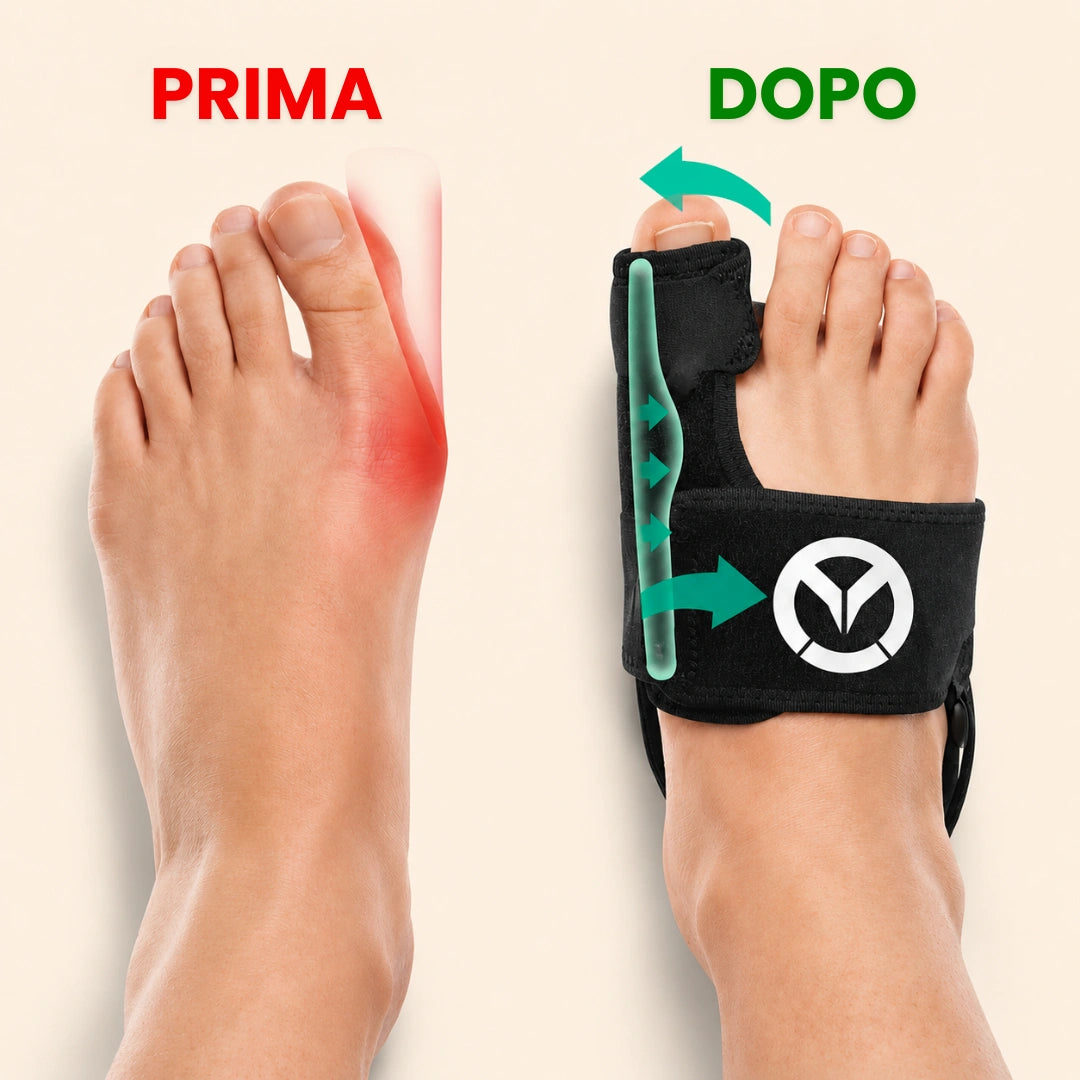 Valgux™ Tutore | Correttore dell’alluce valgo (Hallux Valgus)